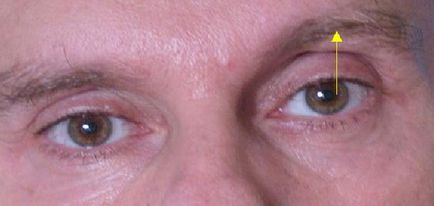 Как да се намали бръчки под очите и около очите, подмладяване на кожата на