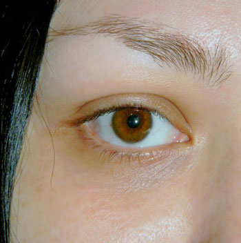 Как да се намали бръчки под очите и около очите, подмладяване на кожата на