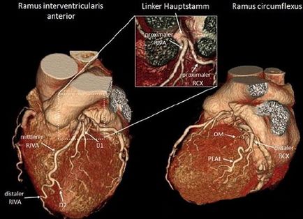 Кт на сърцето и коронарните съдове - което показва към запис за изследване