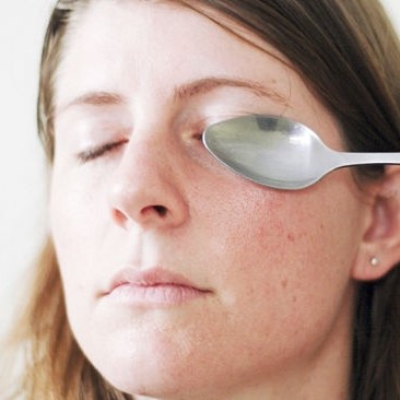 Лечение натъртване под око на първа помощ при нараняване на очите, и ефективна борба с хематом