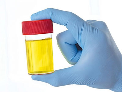 Урина - състав, показания и противопоказания за употреба