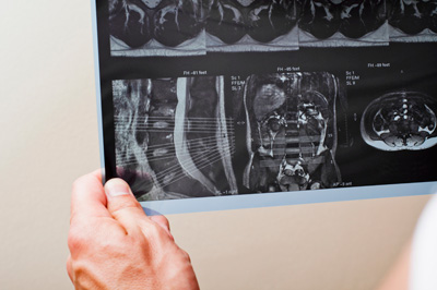 MRI на бъбреците - и на разходите за обучение