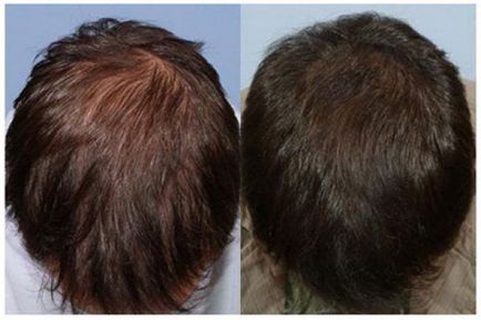Мъжки коса - основа на подходящи грижи