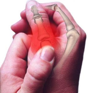 Подуване на пръста на ръката си причини и лечения