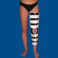 ортопедични коляното
