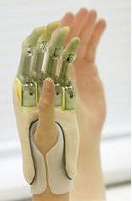 Ортопедична ръцете и пръстите - на палеца, показалеца и други пръсти