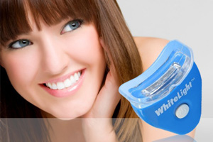 Избелване на зъби бели леки ревюта, инструкции за употреба и цени