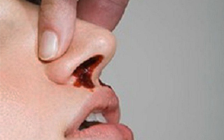Snot от носа с кръвта на възрастни - причини и лечение