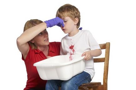 Snot кръв - кръвни причини и лечение на ринит (сопол) Snot с кръв - причини и лечение на обикновена настинка кръвта