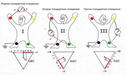 Технологията на електрокардиография - studopediya