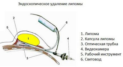 Вън пред очите на посещение причина да се отърве в дома, снимките