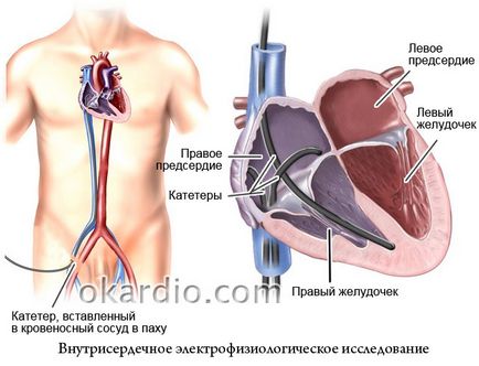 Bigemini какво е