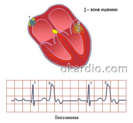 Bigemini какво е