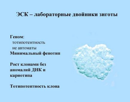 Какво е ESK Какво е ESK