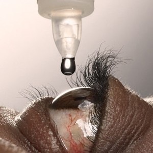 Как да премахнете петната в окото
