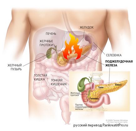 Какво е панкреатит панкреаса