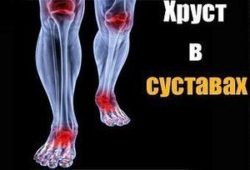 лечение polyosteoarthrosis