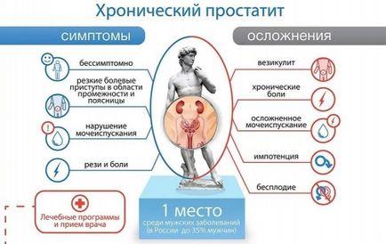 Простатит симптоми при мъжете