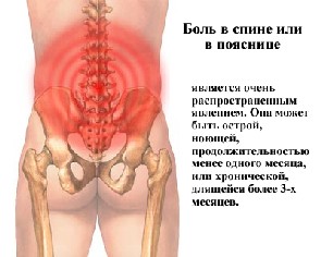 Много болки в долната част на гърба, която е