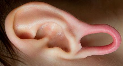 Какво е тунел в ухото