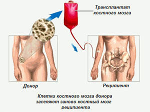 Клиника за трансплантации