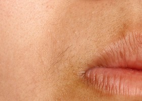 Как да премахнете нежеланото окосмяване по лицето