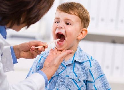 Възпалено гърло при деца - какво и как да се отнасяме медицински сайт