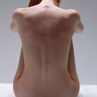 Херпес Body - лекува (херпес) Херпес тяло - Лечение