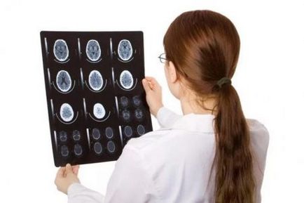 мозъчна исхемия какво е, симптоми и лечение ефекти, степента, колко живо