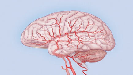 мозъчна исхемия какво е, симптоми и лечение ефекти, степента, колко живо