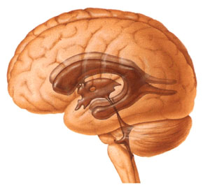 мозъка cavernoma, диагностика и лечение на мозъчни cavernomas в Израел клиники в Израел, Лечение в Израел