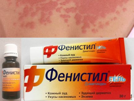 Червени петна по тялото на снимката, причините и възможно заболяване, кожни нодули (петна) Червени петна по тялото на снимката, на причините и е възможно заболяването, образувания по кожата
