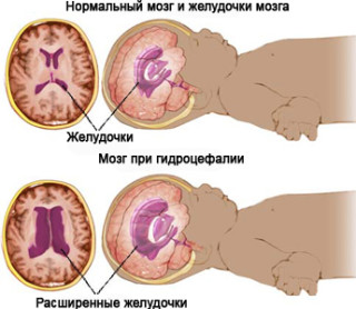MRI на мозъка, докато децата са прави и това показва,