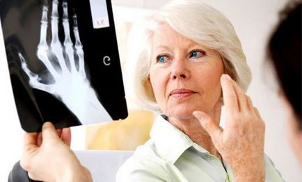 Артрит ставите на пръстите на лечение, причини и симптоми