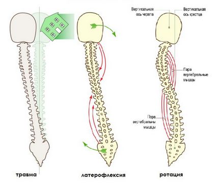 Ефектите на травма (нараняване) Последиците от травми