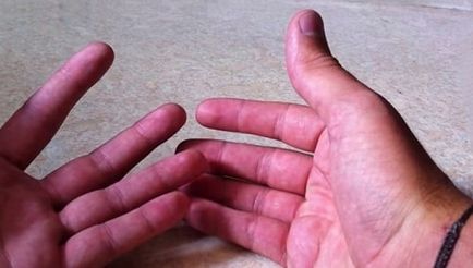 Постоянно изпотяване ръцете причини, лечение, почистване на тялото на човешкото здраве (лечение) Постоянно изпотяване ръцете причини, лечение, почистване на тялото на човешкото здраве