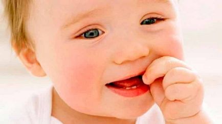Изригване на горните зъби в детските снимки, симптоми