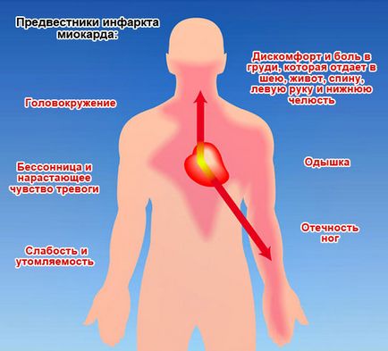 Инфарктът причинява симптомите, лечение и какво да правя