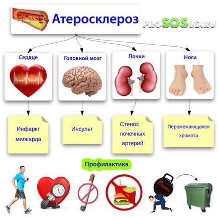 Церебрална съдови лечение генезис