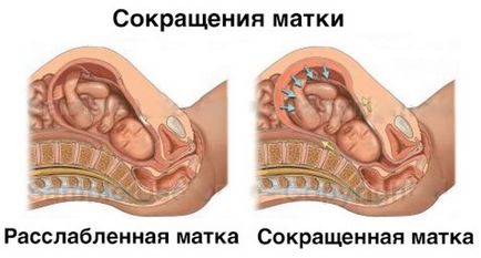 тон на матката по време на бременността симптоми, причини и лечение (тон на матката по време на бременност симптоми 2 триместър) тон на матката по време на бременността симптоми, причини и лечение