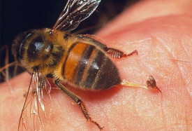 Ужилване от пчела (снимка), първа помощ, симптоми и лечение