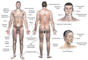Tratamentul Vitiligo simptome foto care aceasta boala, cauzele