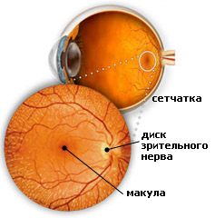 Cauzele macularä, simptome, tratament makulita 1