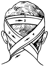 Tipuri de bandaje medicale pe cap