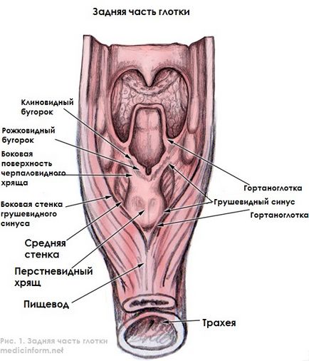 cancer hipofaringian