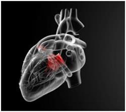 szív egészsége wpw omega 3 6 9 és a szív egészsége