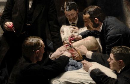 15 маловідомих фактів про шокувала суспільство картині «клініка гроса» реаліста томаса Ікинс
