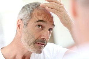 7 Причин випадіння волосся у чоловіків