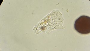 Amoeba vulgaris