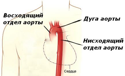 Anevrismul aortei toracice